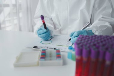 Laboratuvar, bilimsel araştırmalarda terapi aşılarını test etmek ve araştırmak için kullanılıyor, laboratuvar asistanları hastalardan kan örnekleri topluyor ve kimyasal reaksiyonlar gerçekleştiriyor. Laboratuvar kavramı.