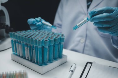 Laboratuvar asistanları kimyasal reaksiyonları, tıbbi bilimcileri, kimyasal araştırmacıları, kimyasal deneyleri ve hasta kan örneklerinden yapılan hastalık testlerini araştırıyorlar. Tıp ve araştırma konsepti