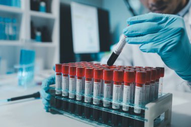 Bir kimyager test tüpündeki kandaki kimyasalları araştırmak için mikroskop kullanıyor, Kimyager test tüplerini kimyasal olarak analiz ediyor, bilim adamı laboratuvarda kimyasallarla deney yapıyor., 