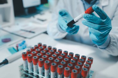 Bir kimyager test tüpündeki kandaki kimyasalları araştırmak için mikroskop kullanıyor, Kimyager test tüplerini kimyasal olarak analiz ediyor, bilim adamı laboratuvarda kimyasallarla deney yapıyor., 