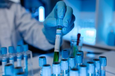 Bir bilim adamı deney için laboratuvar ekipmanı kullanır. Test tüpü kimyagerlerin deneylerde kullanması için gereklidir. Bilimsel araştırmacılar laboratuvar örneklerine yoğunlaşmalıdır.