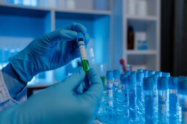 Bir bilim adamı deney için laboratuvar ekipmanı kullanır. Test tüpü kimyagerlerin deneylerde kullanması için gereklidir. Bilimsel araştırmacılar laboratuvar örneklerine yoğunlaşmalıdır.