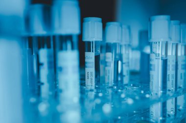 Laboratuvarda bir sürü ekipman var. Laboratuvarın atmosferi, bilim adamlarının işlerini verimli yapmak için kullandıkları deneysel cam eşyalar ile dolu.