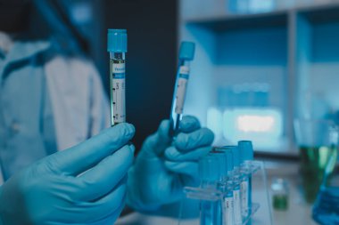 Bir bilim adamı deney için laboratuvar ekipmanı kullanır. Test tüpü kimyagerlerin deneylerde kullanması için gereklidir. Bilimsel araştırmacılar laboratuvar örneklerine yoğunlaşmalıdır.