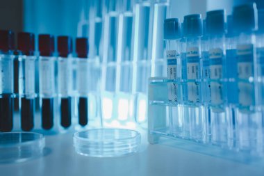 Laboratuvarda bir sürü ekipman var. Laboratuvarın atmosferi, bilim adamlarının işlerini verimli yapmak için kullandıkları deneysel cam eşyalar ile dolu.