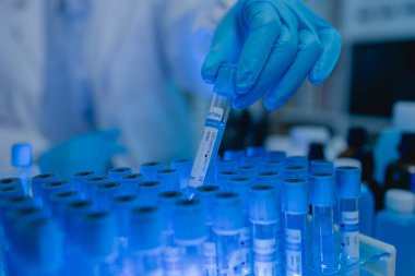 Bir kadın kimyager laboratuvarda çeşitli sıvı bileşiklerini test ediyor, bir bilim adamı laboratuvarda, laboratuarda, laboratuarda, deney tüpünde, bilimsel araştırmalar yapıyor.