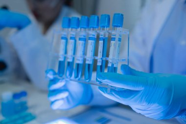 Laboratuvarda bilim adamları laboratuvar önlükleri, lastik eldivenler ve güvenlik gözlükleri takarken, iki kimyager sıvı haldeki kimyasalları test ediyor, kimyagerler laboratuarda çalışıyor.