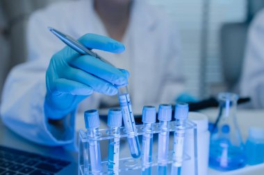 Bir kadın kimyager laboratuvarda çeşitli sıvı bileşiklerini test ediyor, bir bilim adamı bu gelişim üzerine araştırma yapıyor, laboratuvar, test tüpü ve bilimsel ekipmanlarda çalışırken önlük giyiyor.