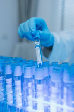 Bir kadın kimyager laboratuvarda çeşitli sıvı bileşiklerini test ediyor, bir bilim adamı laboratuvarda, laboratuarda, laboratuarda, deney tüpünde, bilimsel araştırmalar yapıyor.