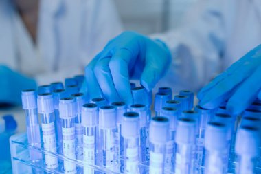 Bir kadın kimyager laboratuvarda çeşitli sıvı bileşiklerini test ediyor, bir bilim adamı bu gelişim üzerine araştırma yapıyor, laboratuvar, test tüpü ve bilimsel ekipmanlarda çalışırken önlük giyiyor.