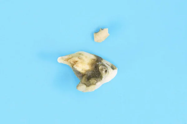 Diente Perro Molar Canino Con Cálculo Dental Pieza Piedra Dentada —  Fotos de Stock