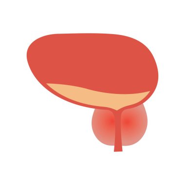 Prostat bezinin şişmesi ve iltihaplanması. İnsan vücudunda hastalık ve ağrı. Mesane anatomisi konsepti. Tıbbi düz vektör çizimi.