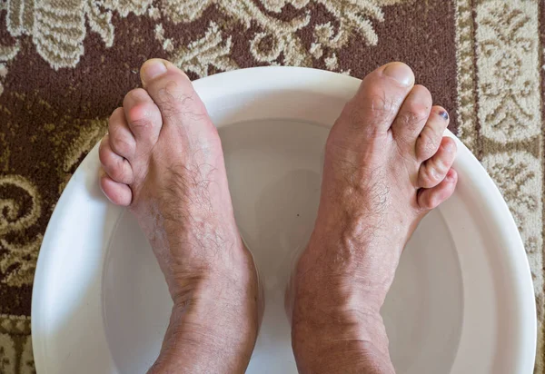 stock image Washing the feet in the lavatory, hammer toes.