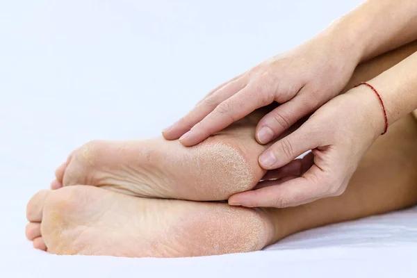 Жіночі Ноги Суха Шкіра Підборах Вибірковий Фокус Люди — стокове фото