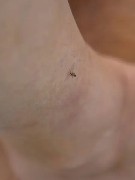 A mosquito bites a person close-up. Selective focus. animal.