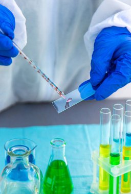 Test tüpleri ve reaksiyonlar laboratuara. Seçici odaklanma. ilaç.