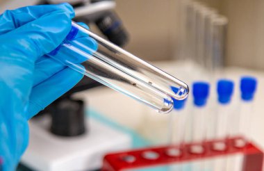 Laboratuvardaki test tüpüne tik tak. Seçici odaklanma. Doğa.