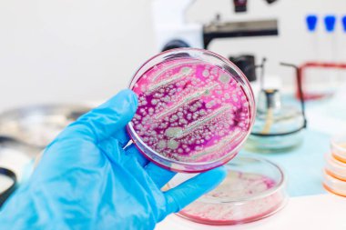 Laboratuvardaki petri kabındaki bakterileri inceleyin. Seçici odaklanma. Doğa.