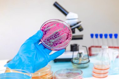 Laboratuvardaki petri kabındaki bakterileri inceleyin. Seçici odaklanma. Doğa.