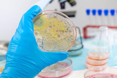 Laboratuvardaki petri kabındaki bakterileri inceleyin. Seçici odaklanma. Doğa.