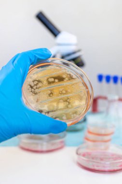 Laboratuvardaki petri kabındaki bakterileri inceleyin. Seçici odaklanma. Doğa.