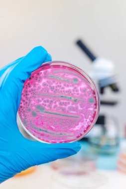 Laboratuvardaki petri kabındaki bakterileri inceleyin. Seçici odaklanma. Doğa.