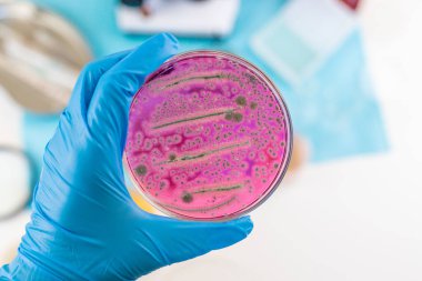 Laboratuvardaki petri kabındaki bakterileri inceleyin. Seçici odaklanma. Doğa.