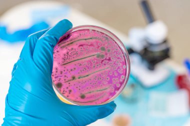 Laboratuvardaki petri kabındaki bakterileri inceleyin. Seçici odaklanma. Doğa.