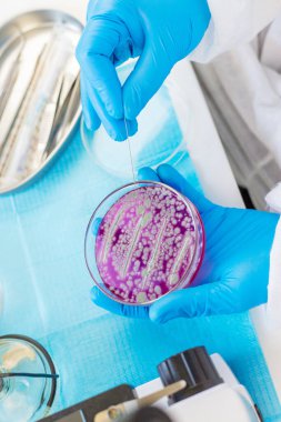 Laboratuvardaki petri kabındaki bakterileri inceleyin. Seçici odaklanma. Doğa.