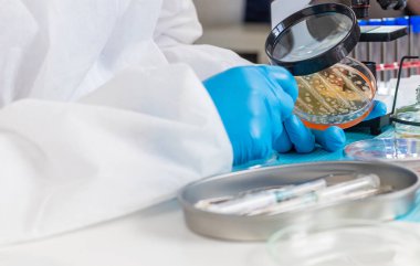 Laboratuvardaki petri kabındaki bakterileri inceleyin. Seçici odaklanma. Doğa.