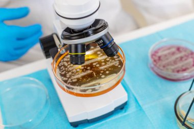 Laboratuvardaki petri kabındaki bakterileri inceleyin. Seçici odaklanma. Doğa.