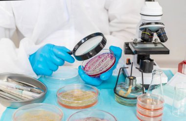 Laboratuvardaki petri kabındaki bakterileri inceleyin. Seçici odaklanma. Doğa.