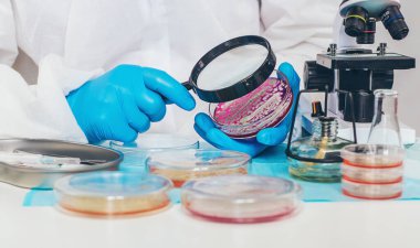 Laboratuvardaki petri kabındaki bakterileri inceleyin. Seçici odaklanma. Doğa.