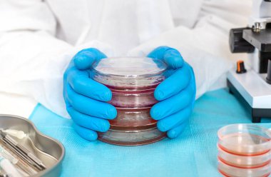 Laboratuvardaki petri kabındaki bakterileri inceleyin. Seçici odaklanma. Doğa.