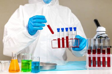 Laboratuvardaki kanı incele. Seçici odaklanma. ilaç.