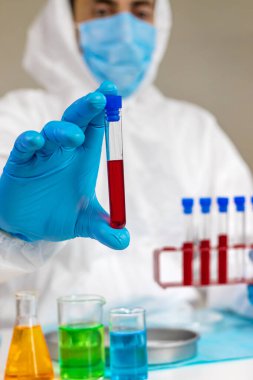 Laboratuvardaki kanı incele. Seçici odaklanma. ilaç.