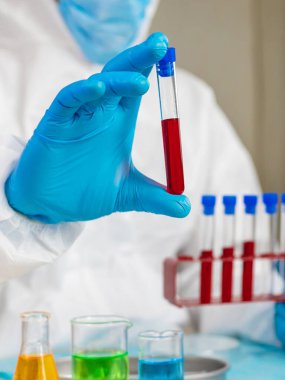 Laboratuvardaki kanı incele. Seçici odaklanma. ilaç.