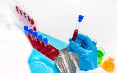 Laboratuvardaki kanı incele. Seçici odaklanma. ilaç.