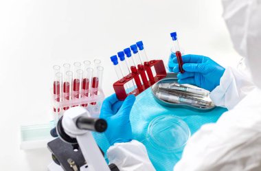 Laboratuvardaki kanı incele. Seçici odaklanma. ilaç.