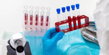 Laboratuvardaki kanı incele. Seçici odaklanma. ilaç.