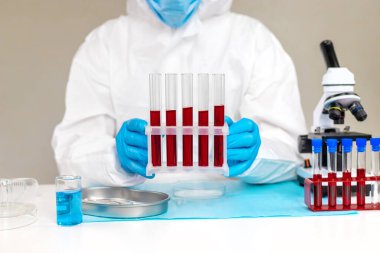 Laboratuvardaki kanı incele. Seçici odaklanma. ilaç.