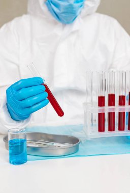 Laboratuvardaki kanı incele. Seçici odaklanma. ilaç.