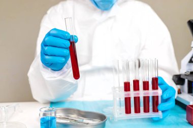 Laboratuvardaki kanı incele. Seçici odaklanma. ilaç.