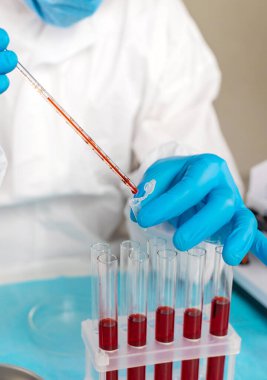 Laboratuvardaki kanı incele. Seçici odaklanma. ilaç.