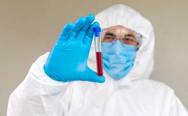 Laboratuvardaki kanı incele. Seçici odaklanma. ilaç.