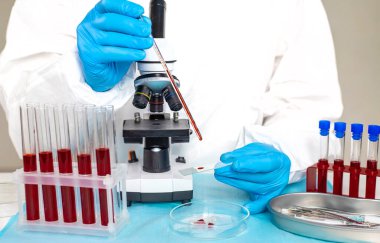 Laboratuvardaki kanı incele. Seçici odaklanma. ilaç.