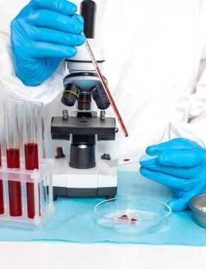 Laboratuvardaki kanı incele. Seçici odaklanma. ilaç.