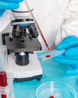 Laboratuvardaki kanı incele. Seçici odaklanma. ilaç.