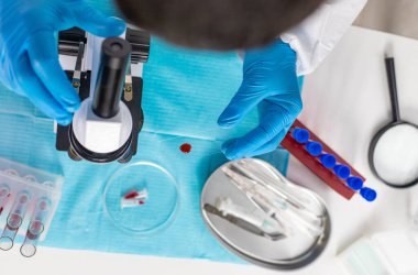 Laboratuvardaki kanı incele. Seçici odaklanma. ilaç.