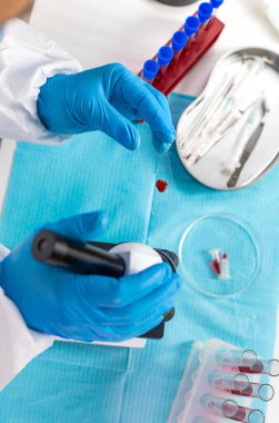 Laboratuvardaki kanı incele. Seçici odaklanma. ilaç.